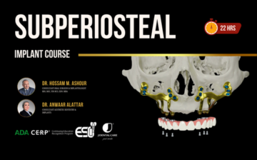 Subperiosteal