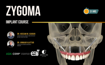 zygoma