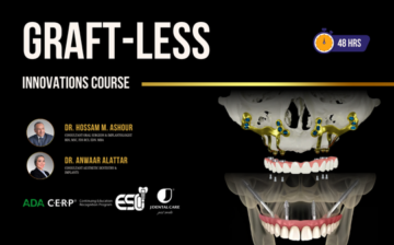 Graft-Less