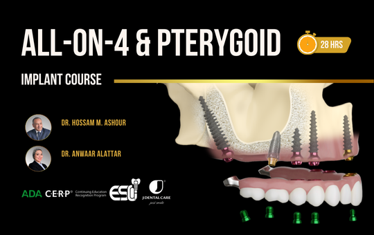 ALL-ON-4 and Pterygoid Implant